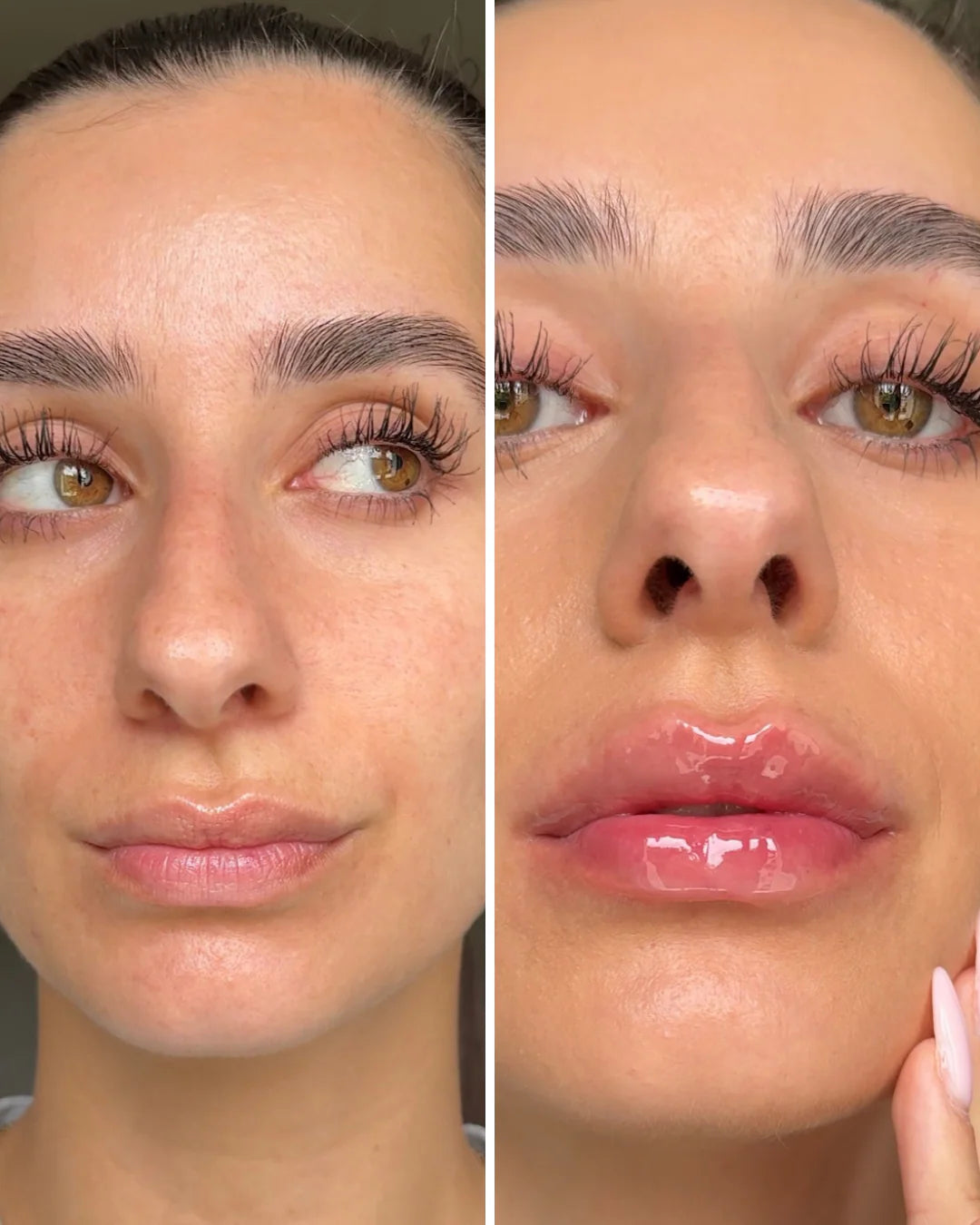 Extreme Lip Plumper