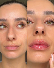 Extreme Lip Plumper