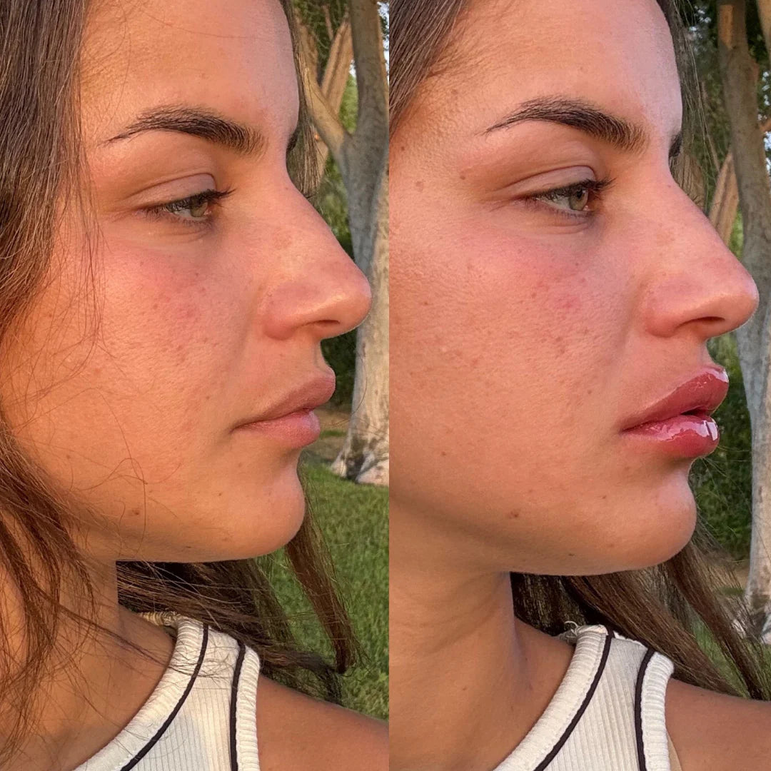 Extreme Lip Plumper