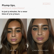 Extreme Lip Plumper